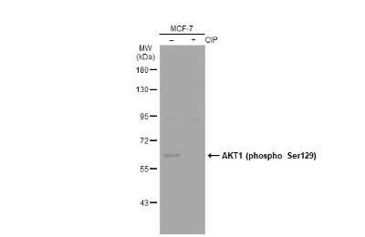 Western Blot: AKT1 [p Ser129] Antibody [NBP3-13418]